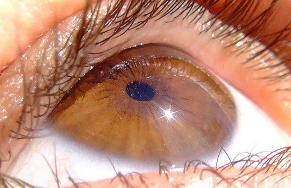 Грустные глаза